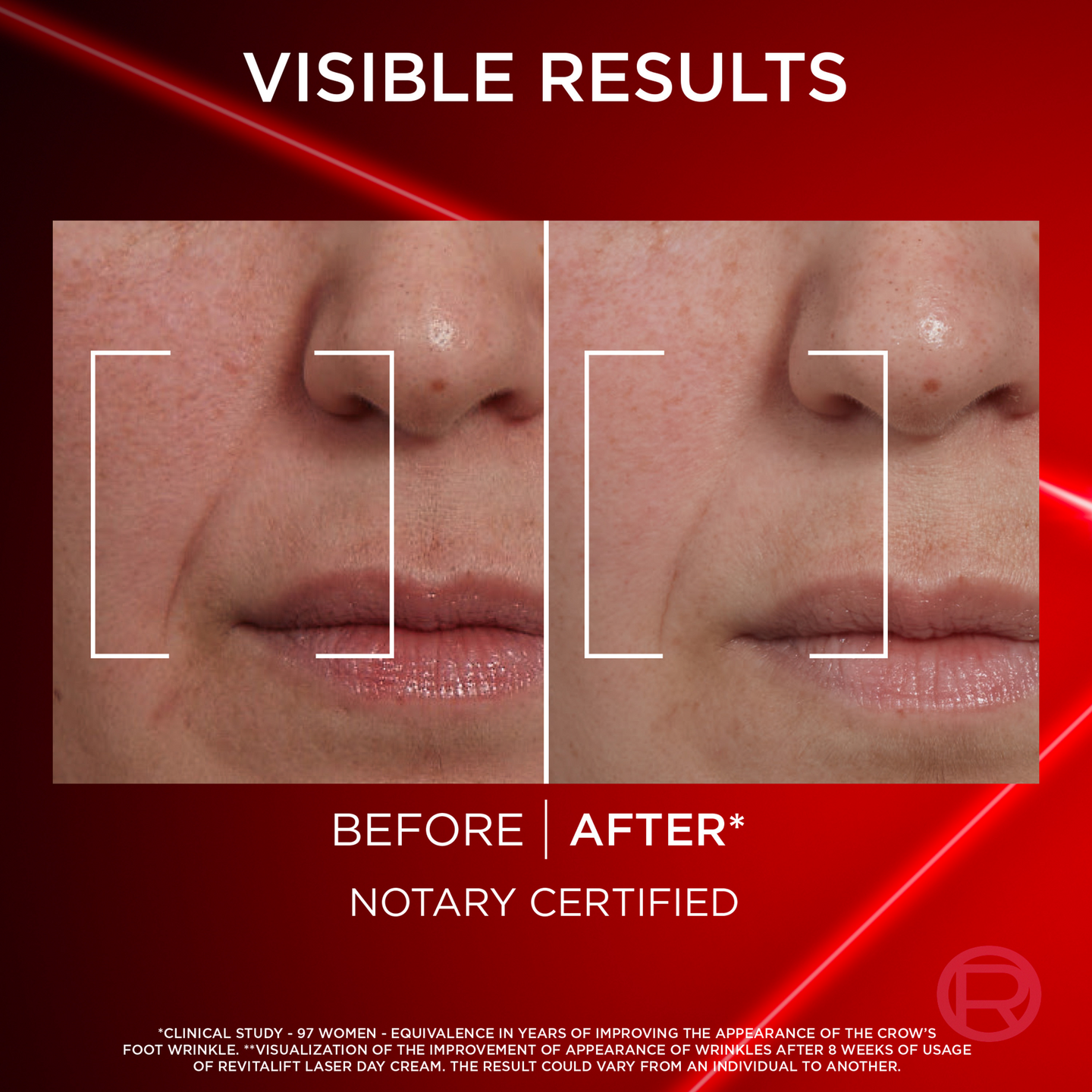 L'Oréal Paris Revitalift Laser päivävoide 50ml edistyksellinen anti-age
