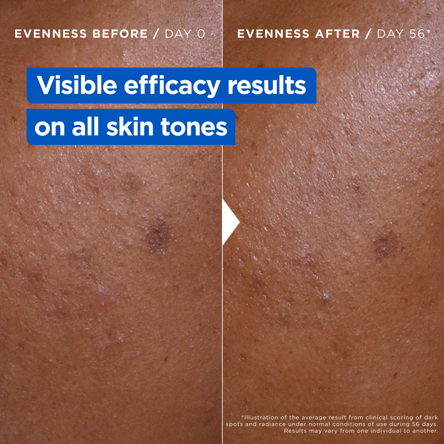 Mixa Niacinamide Bright Ravitseva voide tummia läiskiä vastaan, erittäin kuivalle iholle 400ml