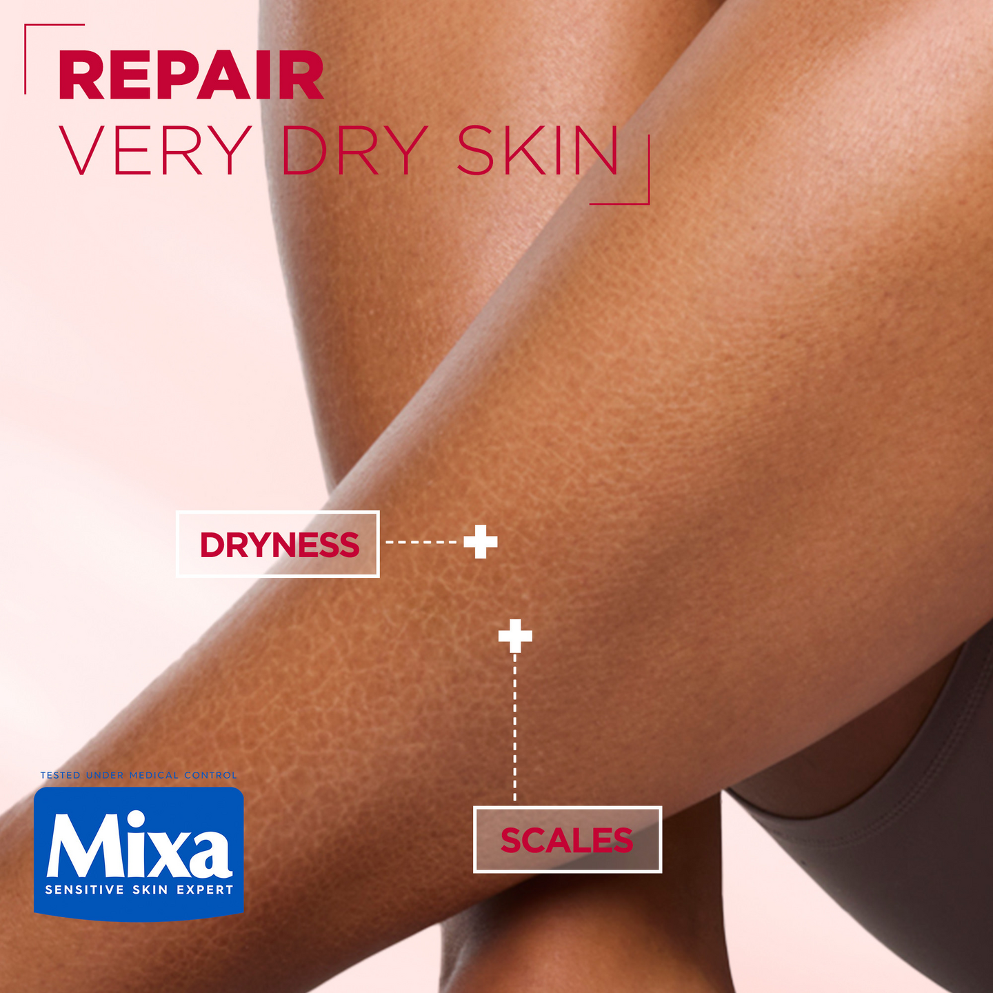 Mixa Urea Cica Repair Renewing Cream Ihoa uudistava voide kuivalle ja karhealle iholle 400ml